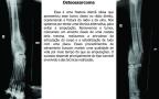 __wf__arquivos/imagens/caso_1.jpg